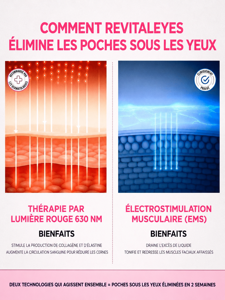 GlowEyes 2-en-1 Lumière rouge + Micro-courant pour atténuer cernes et poches